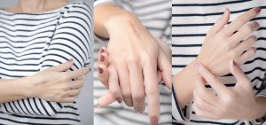 Chuẩn bị trước khi phẫu thuật sửa chữa sẹo