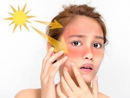 Bảo vệ da khỏi ánh nắng mặt trời